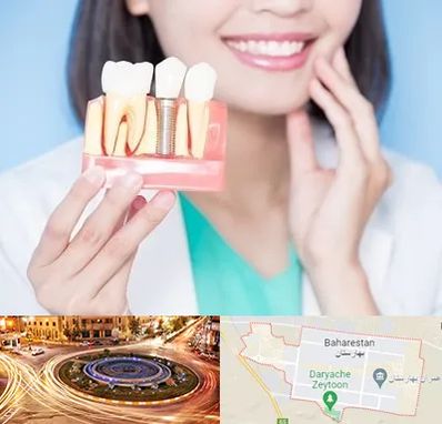 متخصص ایمپلنت در بهارستان