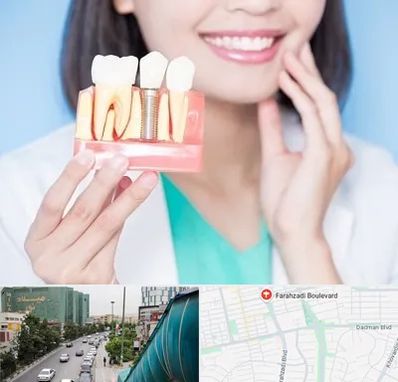 متخصص ایمپلنت در بلوار فرحزادی