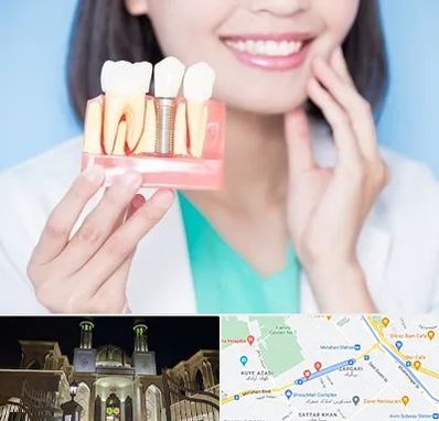 متخصص ایمپلنت در زرگری شیراز