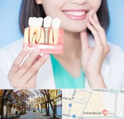 متخصص ایمپلنت در تربیت تبریز