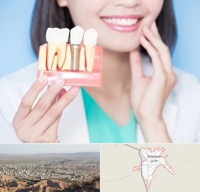 متخصص ایمپلنت در اسفراین
