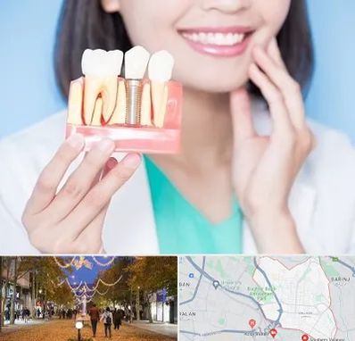 متخصص ایمپلنت در ولیعصر ارومیه