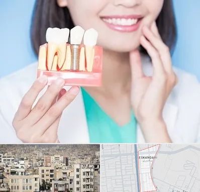 متخصص ایمپلنت در اسکندری