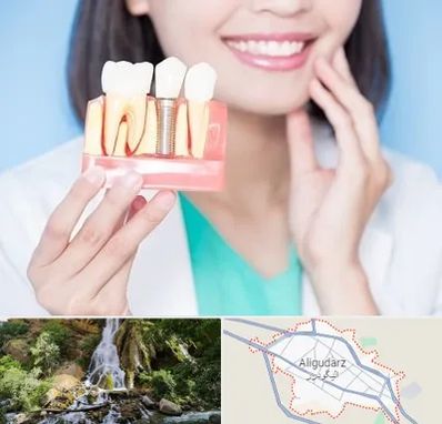 متخصص ایمپلنت در الیگودرز