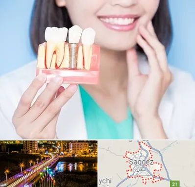 متخصص ایمپلنت در سقز