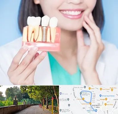 متخصص ایمپلنت در فلکه گاز رشت