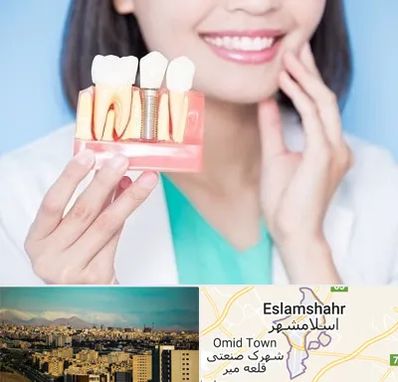 متخصص ایمپلنت در اسلامشهر