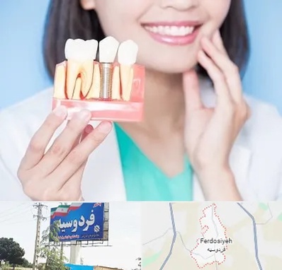 متخصص ایمپلنت در فردوسیه شهریار