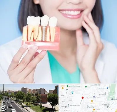 متخصص ایمپلنت در شهرک آزمایش