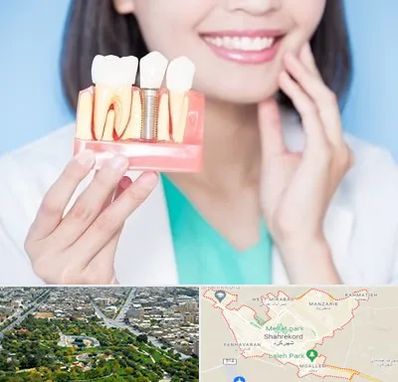 متخصص ایمپلنت در شهرکرد