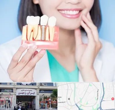 متخصص ایمپلنت در ایران زمین