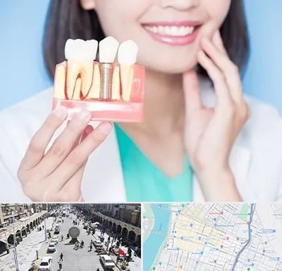 متخصص ایمپلنت در نادری اهواز