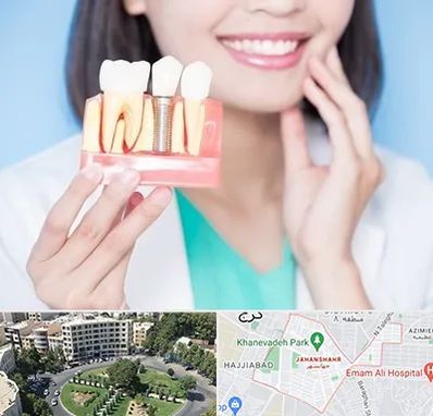 متخصص ایمپلنت در جهانشهر کرج