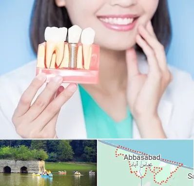 متخصص ایمپلنت در عباس آباد