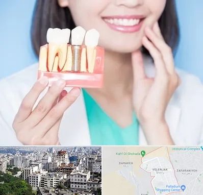 متخصص ایمپلنت در ولنجک