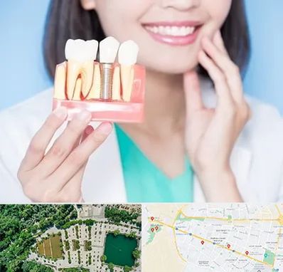 متخصص ایمپلنت در وکیل آباد مشهد