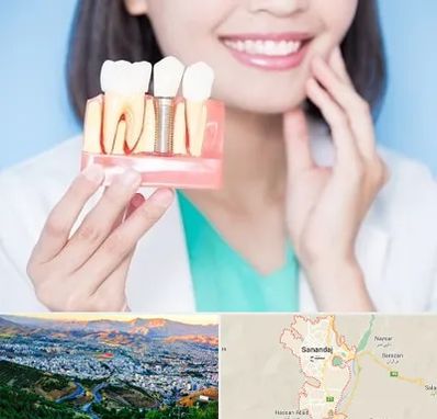 متخصص ایمپلنت در سنندج