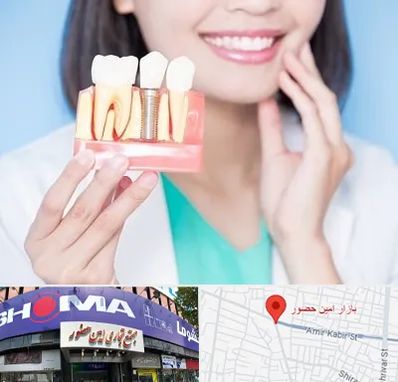 متخصص ایمپلنت در امین حضور