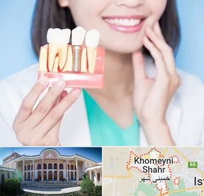 متخصص ایمپلنت در خمینی شهر