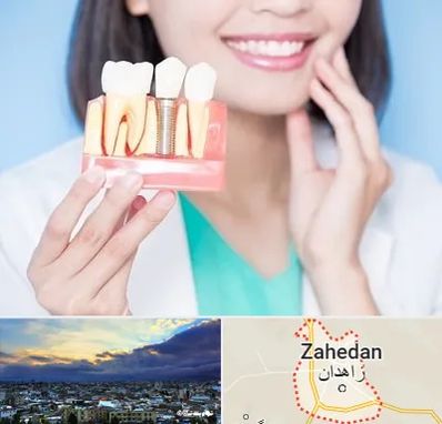 متخصص ایمپلنت در زاهدان