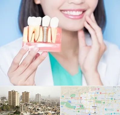متخصص ایمپلنت در منطقه 5 تهران