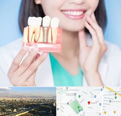 متخصص ایمپلنت در هنگام