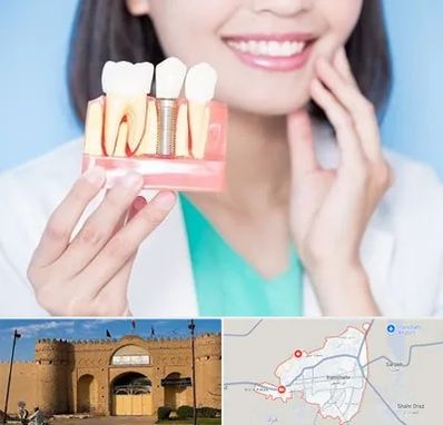 متخصص ایمپلنت در ایرانشهر