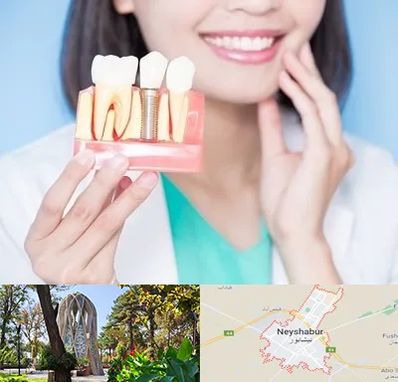 متخصص ایمپلنت در نیشابور