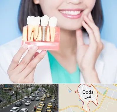 متخصص ایمپلنت در شهر قدس