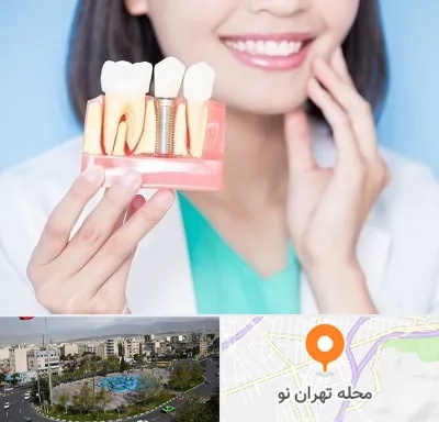 متخصص ایمپلنت در تهران نو