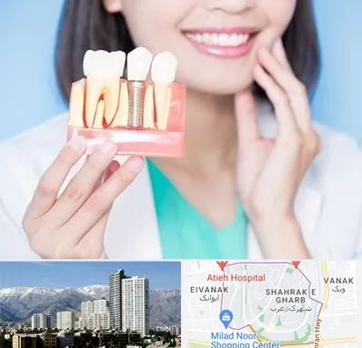 متخصص ایمپلنت در شهرک غرب تهران