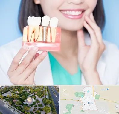 متخصص ایمپلنت در کاشمر