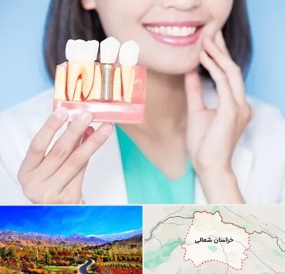 متخصص ایمپلنت در خراسان شمالی