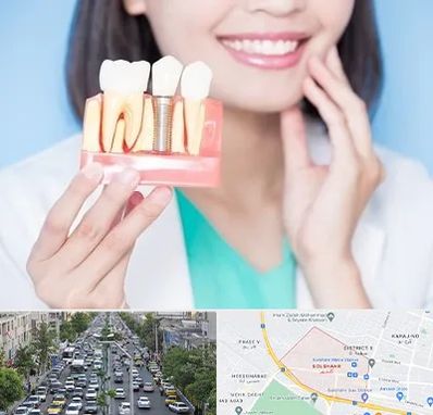 متخصص ایمپلنت در گلشهر کرج