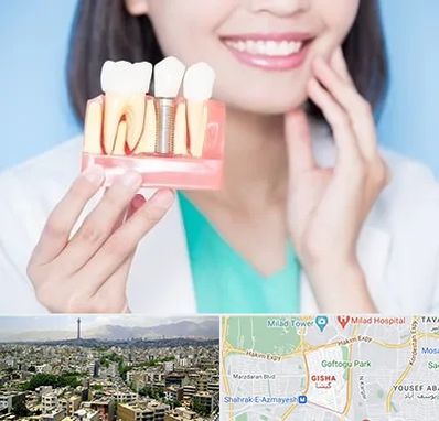 متخصص ایمپلنت در گیشا