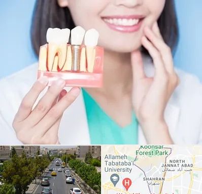 متخصص ایمپلنت در شهران