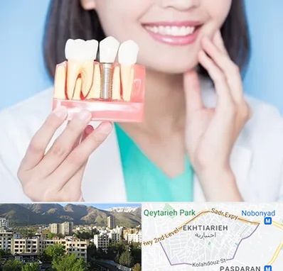 متخصص ایمپلنت در اختیاریه