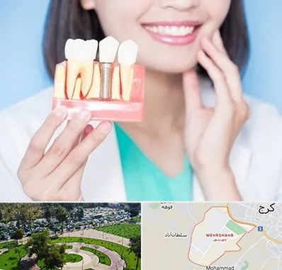 متخصص ایمپلنت در مهرشهر کرج