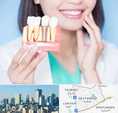 متخصص ایمپلنت در قیطریه