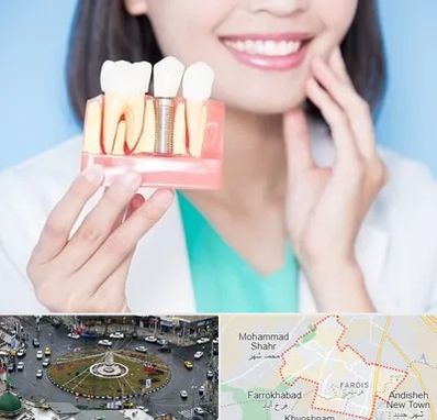 متخصص ایمپلنت در فردیس کرج