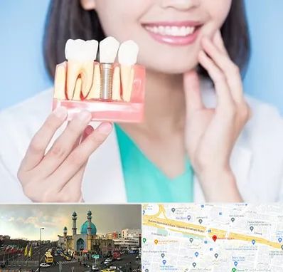 متخصص ایمپلنت در رسالت