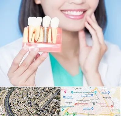 متخصص ایمپلنت در شهرک غرب مشهد