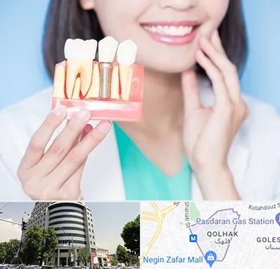 متخصص ایمپلنت در قلهک