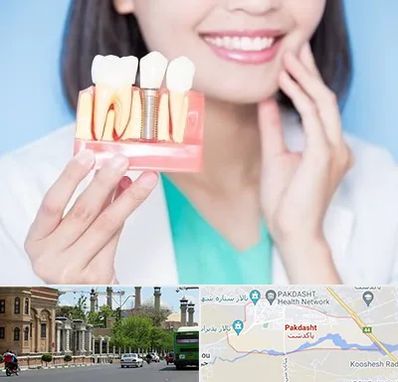متخصص ایمپلنت در پاکدشت