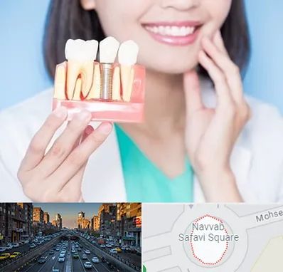 متخصص ایمپلنت در نواب