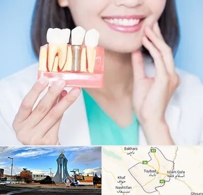 متخصص ایمپلنت در تایباد