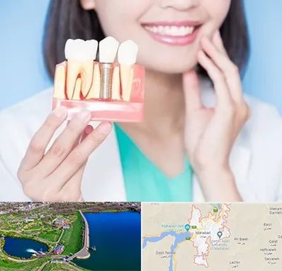 متخصص ایمپلنت در مهاباد