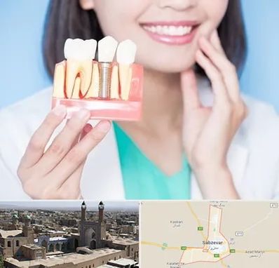 متخصص ایمپلنت در سبزوار