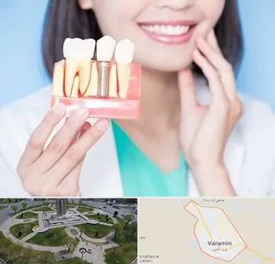متخصص ایمپلنت در ورامین