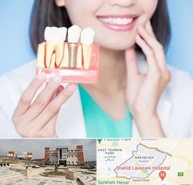 متخصص ایمپلنت در حکیمیه